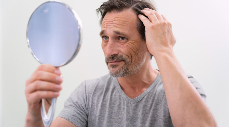Man getting hair loss treatment