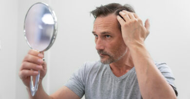 Man Getting Hair Loss Treatment (1)