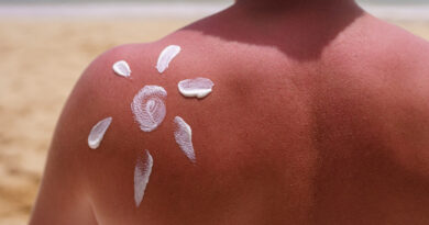 view-man-applying-lotion-sunburn-skin-beach